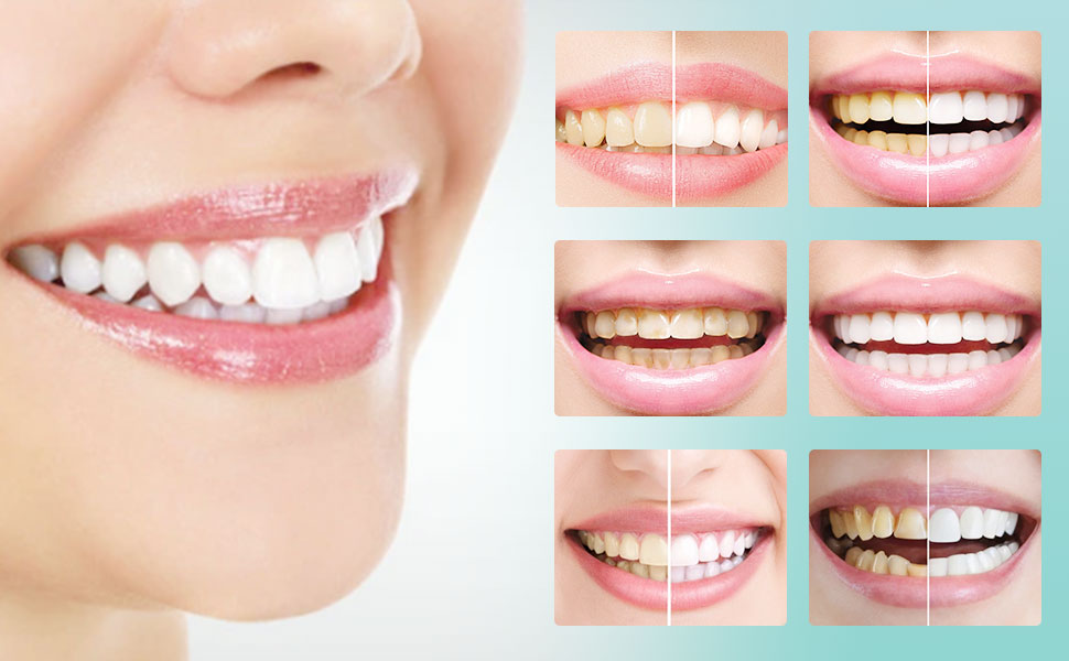 بهترین خمیردندان ضد پوسیدگی در سال  2025 کدامست؟